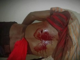 Haïti - FLASH : Manifestation réprimée par les CIMO, 1 mort et 2 blessés par balles