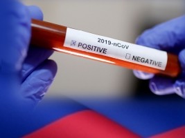 Haiti - FLASH : Covid-19, 10 new cases and 1 more death