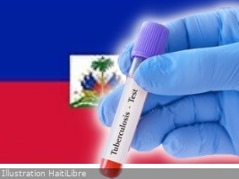Haïti - FLASH : Chaque heure, plus d’un haïtien est infecté par la tuberculose