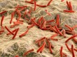 Haïti - Santé : Premier cas de lèpre au Chili diagnostiquée chez un patient haïtien