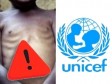 Haïti - FLASH : 1 enfant sur 2 dépendra de l’aide humanitaire pour survivre en 2023