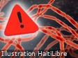 Haïti - ALERTE : Maladie du charbon (Anthrax), Haïti prend les premières mesures sanitaires