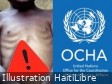 Haiti - FLASH : 21,500 children admitted for treatment of severe acute malnutrition